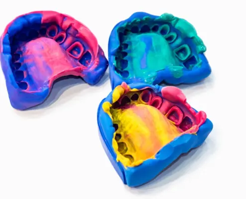 Verschiedene Zahnspangenmaterialien werden in eine Schablone gegossen zur Herstellung einer Spange