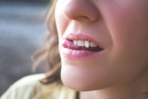 Frau öffnet Mund mit schiefen Zähnen