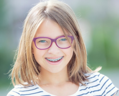 blondes Kind mit lila-farbiger Brille und einer festen Zahnspange mit blauen Gummis