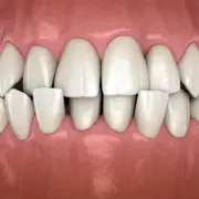 3D-Ansicht von Kreubiss