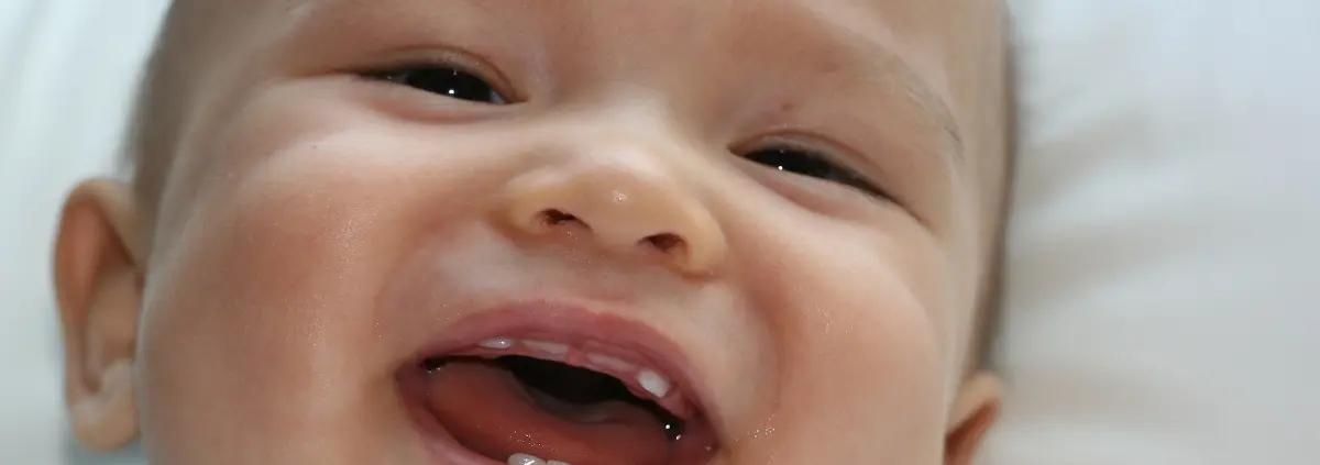 Zahndurchbruch bei Kindern